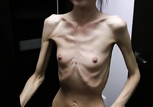 Anorexic Denisa posing and has ribs specious