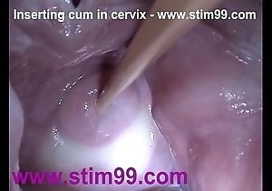 Stick in jizz cum in cervix up dilatation cunt send back