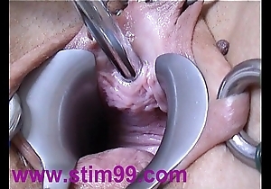 Peehole order making out urethral prudent tip-in dilatation